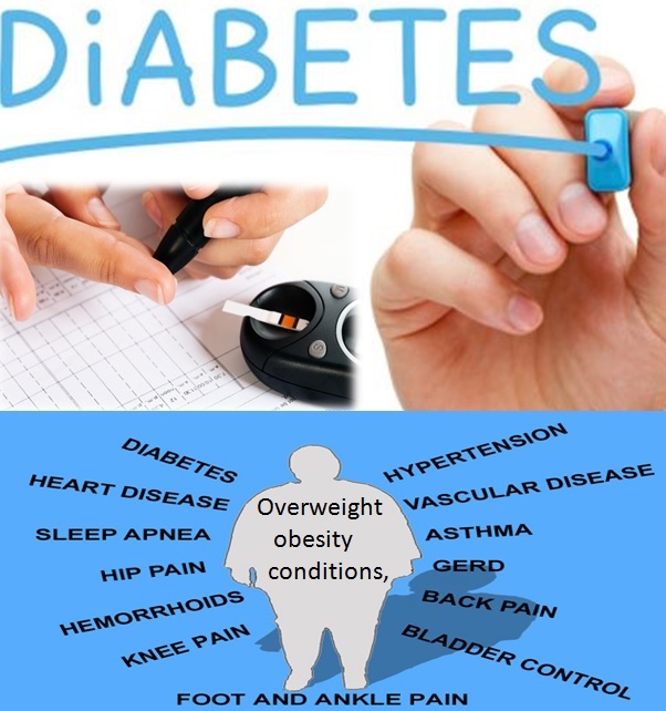 factors of increasing cases of diabetes